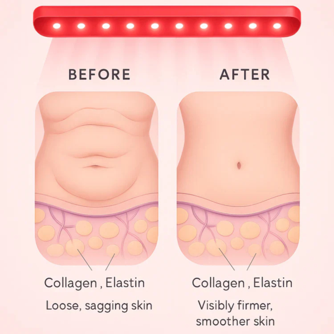 Helmedic™ - LuxFlex