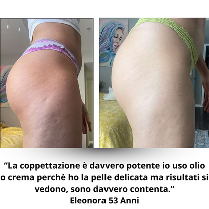 Helmedic™- Cups Anti Cellulite